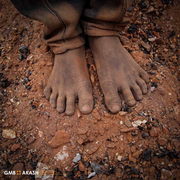 ‘Feet tell stories’ | GMB AKASH